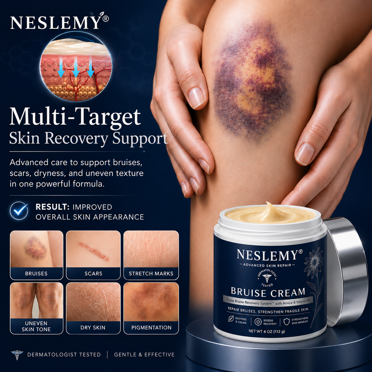 💥100K+ SOLD💕- NESLEMY® Bruise Repair & Skin-Strengthening Cream